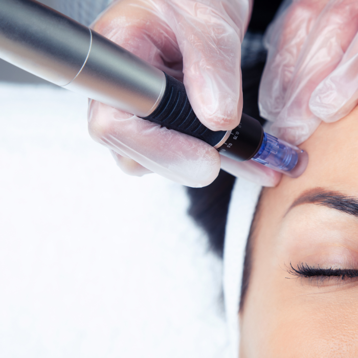 Dermapen