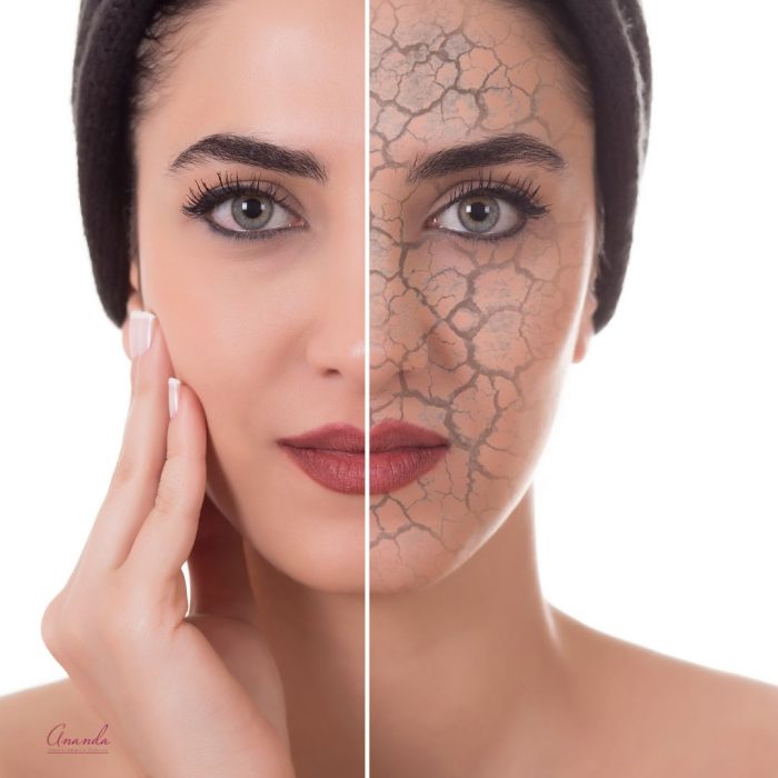 Mesoterapia Vitaminas Faciales
