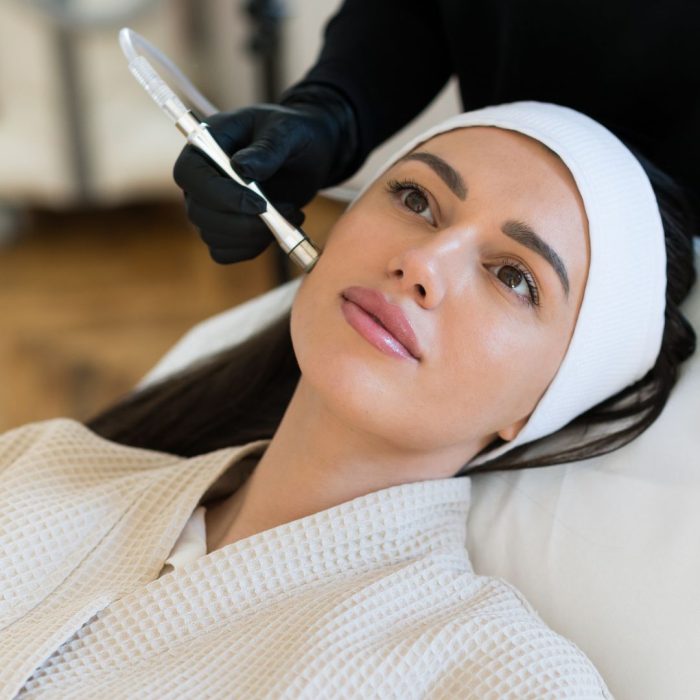 Higiene facial con Microdermoabrasión